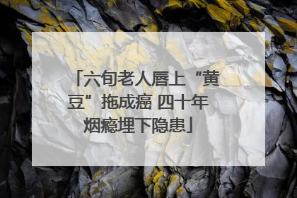 六旬老人唇上“黄豆”拖成癌 四十年烟瘾埋下隐患
